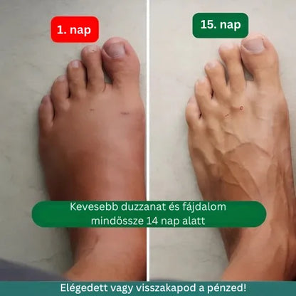 Zenstride® Légáteresztő kompressziós zokni fájdalommentes lábakhoz és talpakhoz