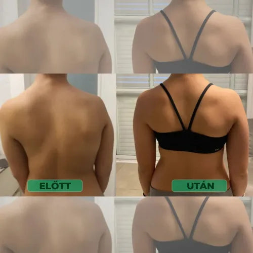 Testtartás-javító – Állj egyenesen. Enyhítsd a hátfájást. Érezd a különbséget már az első napon.