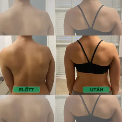 Testtartás-javító – Állj egyenesen. Enyhítsd a hátfájást. Érezd a különbséget már az első napon.