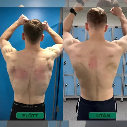 Testtartás-javító – Állj egyenesen. Enyhítsd a hátfájást. Érezd a különbséget már az első napon.