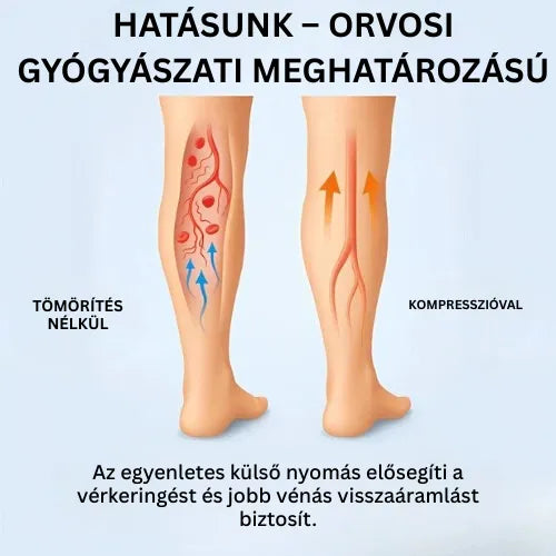 Zenstride® Légáteresztő kompressziós zokni fájdalommentes lábakhoz és talpakhoz